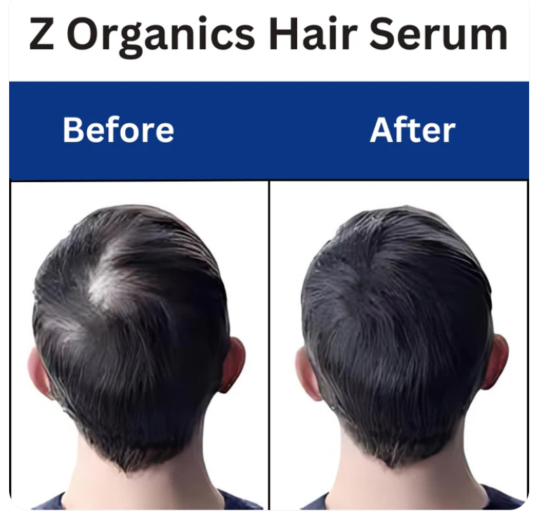 z organic hair serum 30 ml